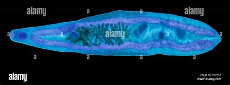  Clonorchis Sinensis: This Fluke Can Turn Your Liver into its Own Private Spa!