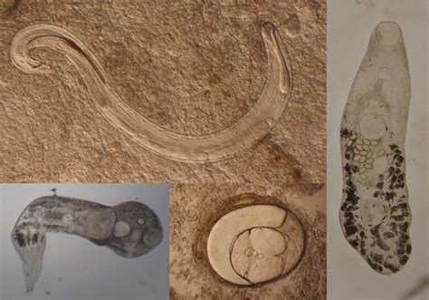  Xenotrema! This Tiny Trematode Holds Secrets To A Parasitic Lifestyle Beyond Belief