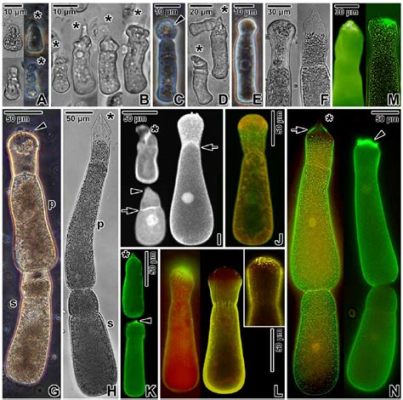 Gregarina! A Microscopic Marvel That Lives Life Inside Its Host